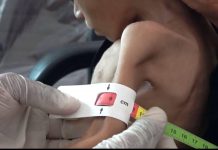 “Mund të numëroj brinjët e tyre”: Al Jazeera tregon për fëmijët jemenas që po vdesin nga uria