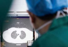 Imuniteti ndaj COVID-19 mund të zhduket në disa muaj